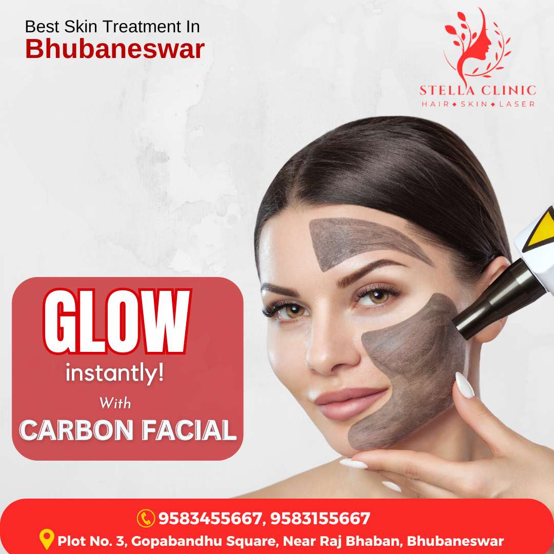 Carbon Facial in Bhubaneswar