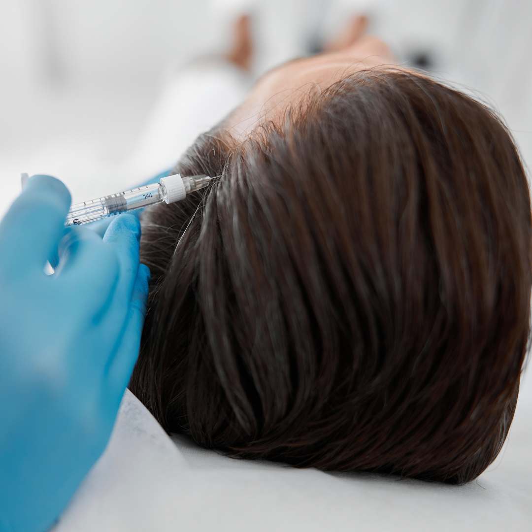 PRP Hair Treatment