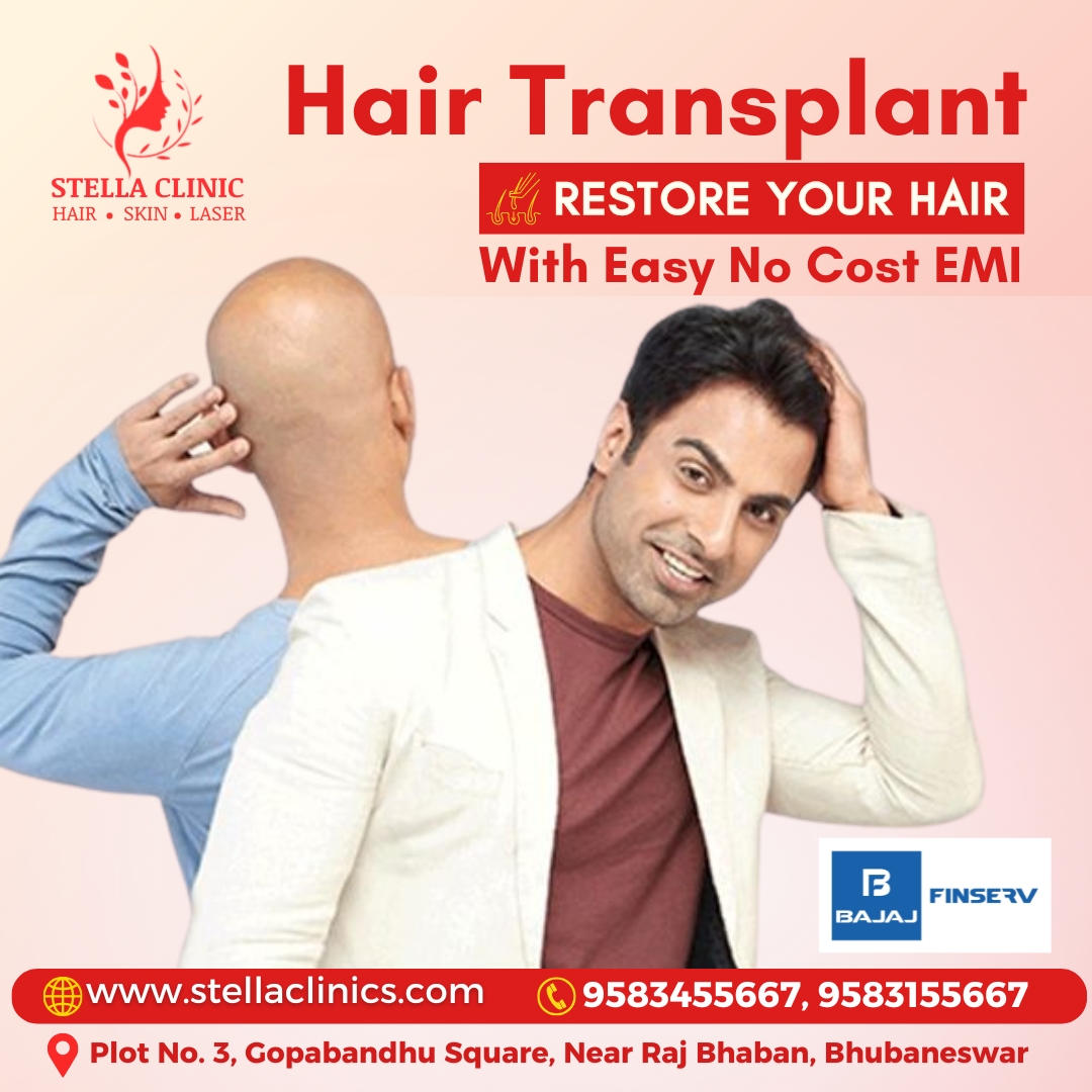 Hair Transplant in Bhubaneswar