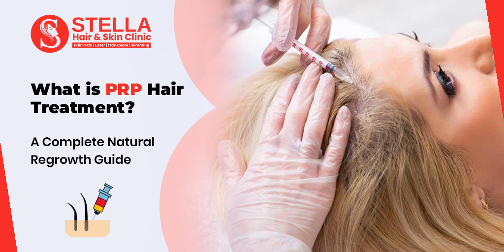 The Regrowth That Works Naturally With PRP Treatment For Hair