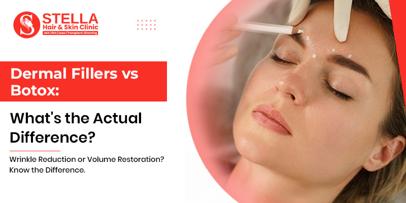 Dermal Fillers vs Botox: What's the Actual Difference?